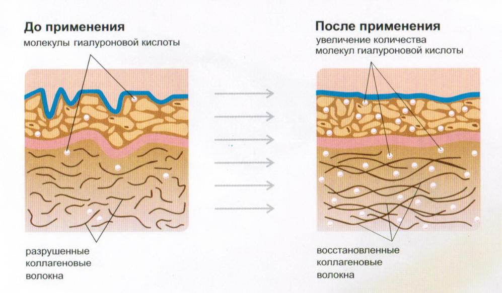 Как сохранить красоту после менопаузы