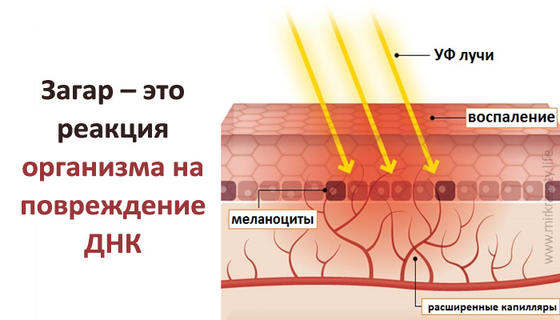 Загар — реакция организма на повреждение ДНК