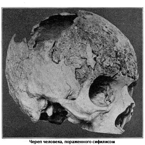 Я - медсестра. И вы не поверите, но люди все еще верят в эти 19 мифов о сексе и здоровье