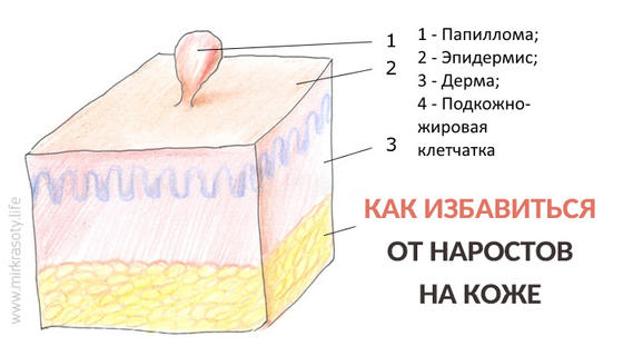 Как избавиться от «висюлек» на коже