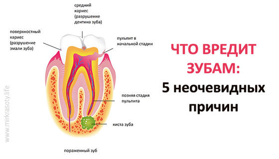 Что вредит зубам: 5 неочевидных причин