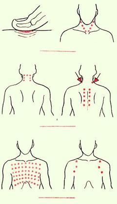 Шиацу-массаж при простудных заболеваниях
