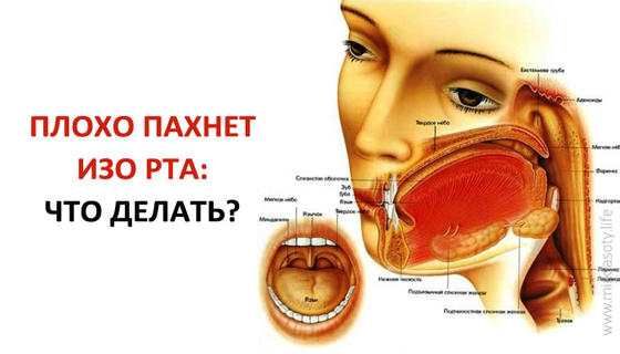 Что делать, если плохо пахнет изо рта