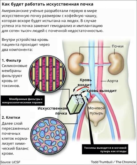 Создана первая в мире бионическая почка! Вот как она работает