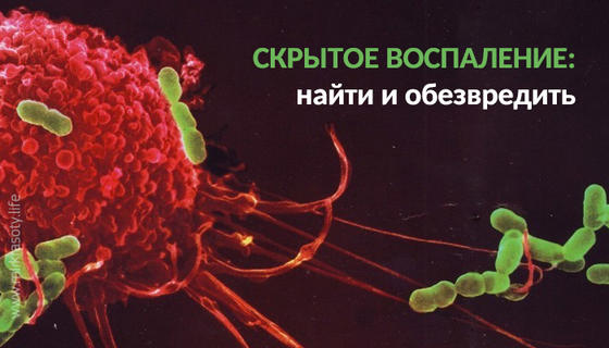 Скрытое воспаление: найти и обезвредить