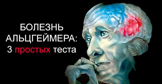 Узнайте не грозит ли Вам болезнь Альцгеймера — 3 простых теста