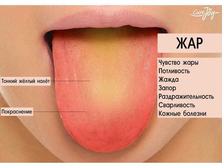 Вот как узнать, нет ли у вас какой-то болезни, по языку.  Непонятно, как, но работает! 