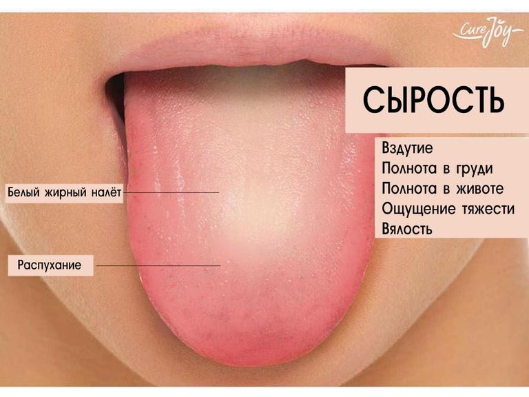 Вот как узнать, нет ли у вас какой-то болезни, по языку.  Непонятно, как, но работает! 