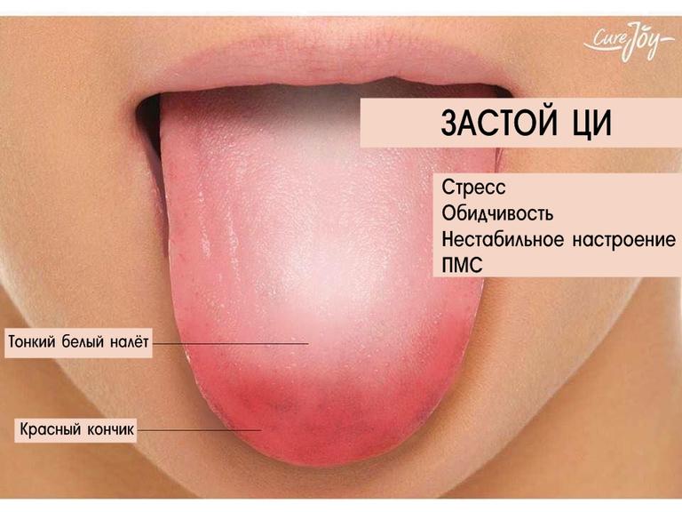 Вот как узнать, нет ли у вас какой-то болезни, по языку.  Непонятно, как, но работает! 