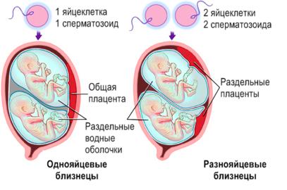 22 совета, которые повысят ваши шансы родить двойню Для тех, кто хочет близняшек!