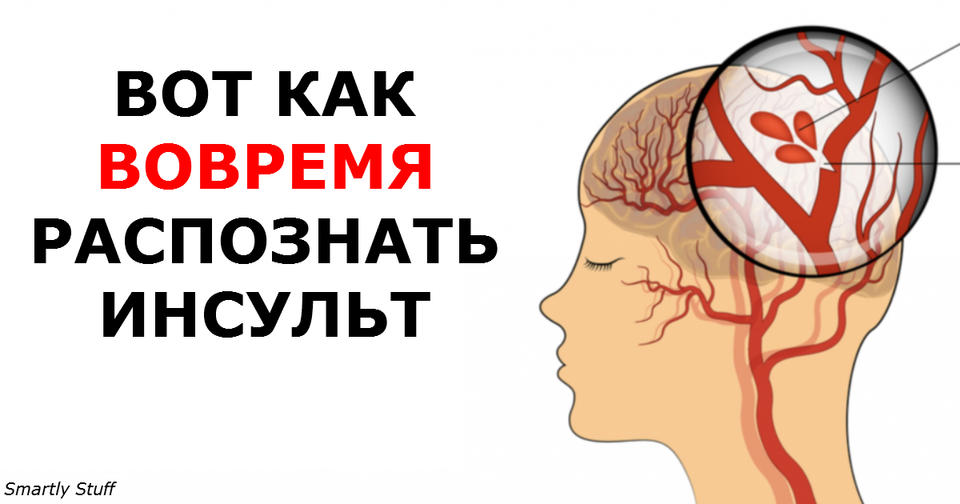 Чтобы понять, инсульт у человека или нет, попросите сделать эти 3 вещи! Если не сможет   беда!