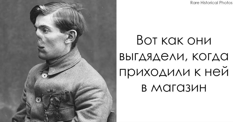 Невероятные фото ″До″ и ″После″ ветеранов, которым она ″восстановила″ лица Она изменила их жизни!