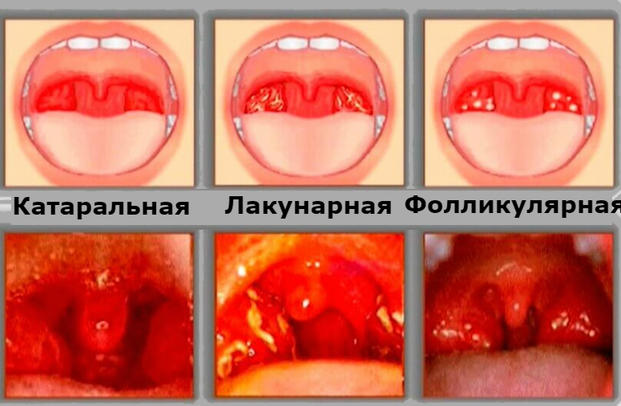 11 детских болезней, которые важно уметь отличать от простуды То, о чем должен знать каждый родитель.