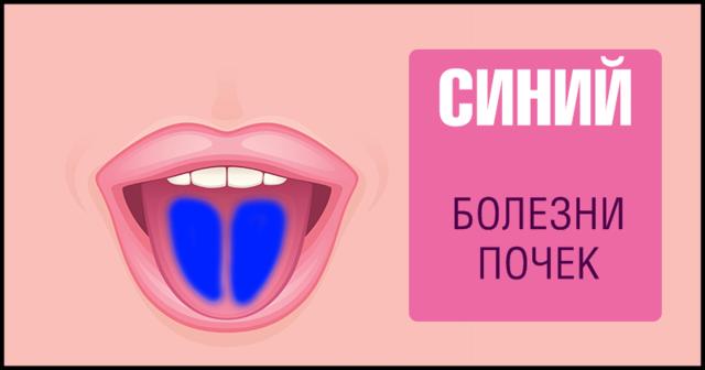 9 фактов о здоровье, о которых можно узнать, просто высунув язык Самодиагностика на дому.