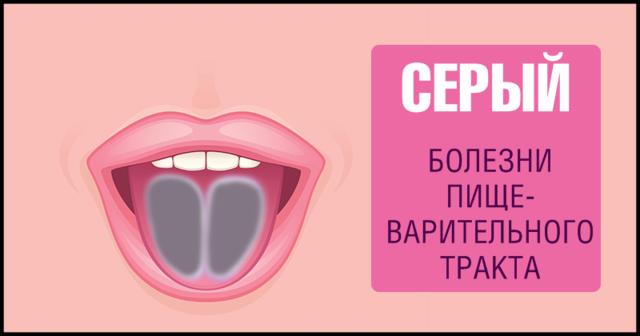 9 фактов о здоровье, о которых можно узнать, просто высунув язык Самодиагностика на дому.