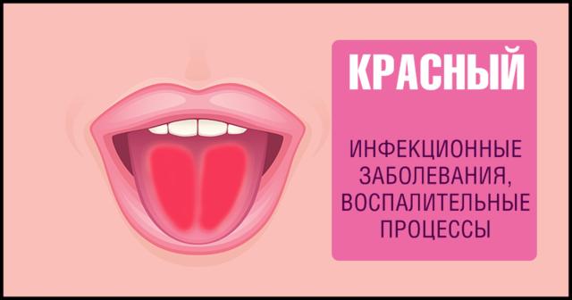 9 фактов о здоровье, о которых можно узнать, просто высунув язык Самодиагностика на дому.