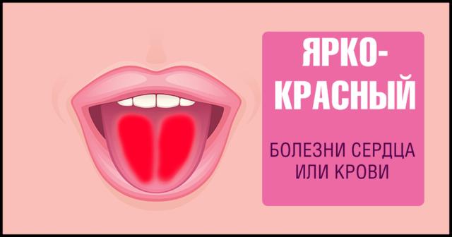 9 фактов о здоровье, о которых можно узнать, просто высунув язык Самодиагностика на дому.