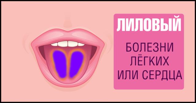 9 фактов о здоровье, о которых можно узнать, просто высунув язык Самодиагностика на дому.