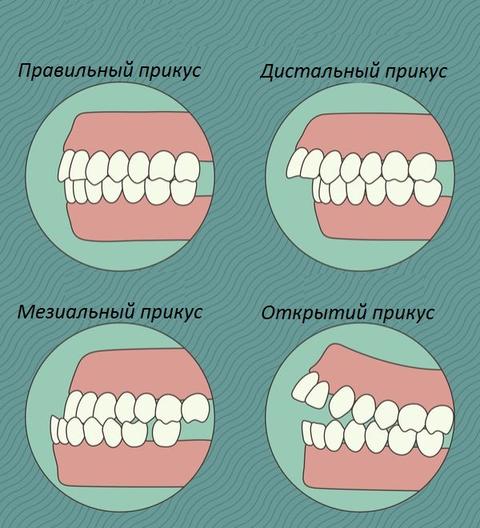 Челюсть и позвоночник - связаны. Болит спина - лечите зубы! Кто бы подумал!