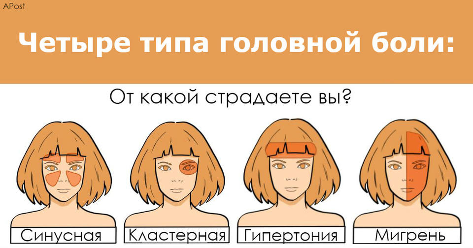 Врач рассказал, что есть 4 типа головных болей. Вот что делать с каждой из них Очень полезная информация.