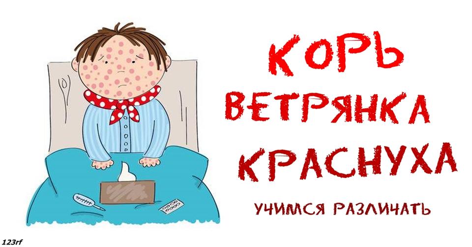 Корь, ветрянка или краснуха: фото, по которым вы сможете отличить их друг от друга Наглядный путеводитель по болезням.