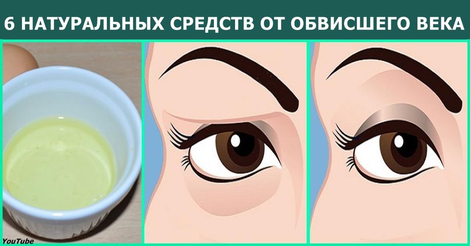 Опущенные веки — проблема, которая касается всех. Вот 6 способов её решить