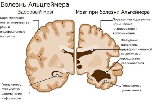 9 привычек, которые могут предотвратить слабоумие в старости