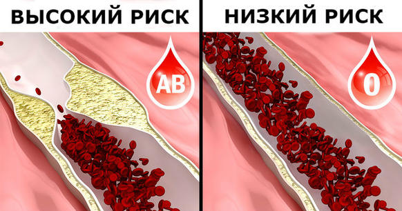 8 вещей, которые надо знать, если у вас первая группа крови