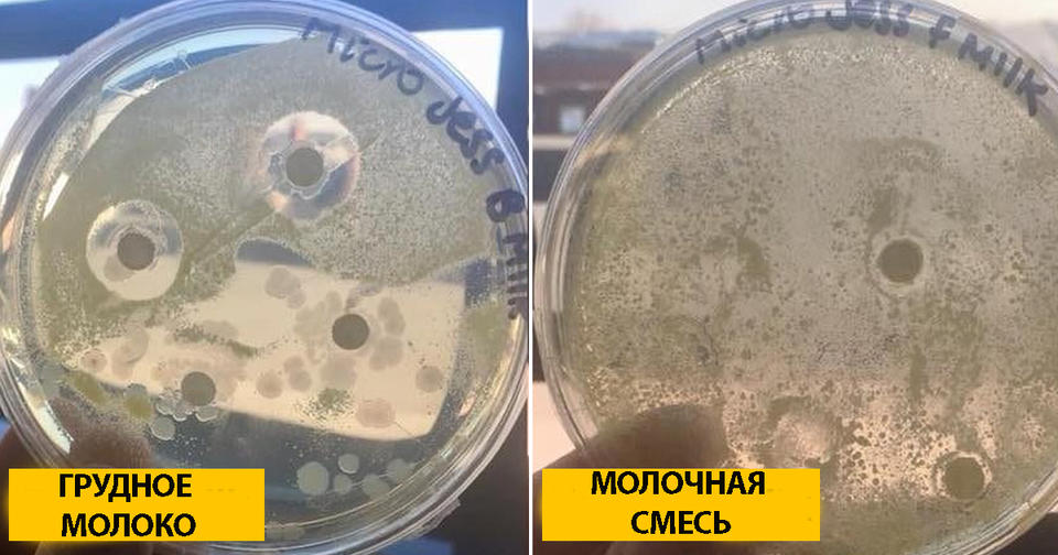 Мама показала, как грудное молоко - буквально - разгоняет вредные бактерии