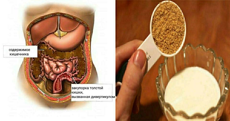 Чтобы прочистить толстую кишку, нужно только 2 ингредиента