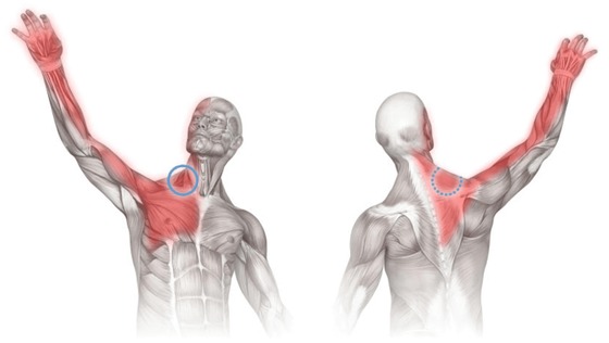 Триггерные точки и злоупотребление мышцами