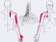 Карта триггеров: точки боли и точки напряжения мышц 