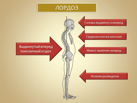 Упражнения для правильной осанки и устранения дефектов костно мышечной системы