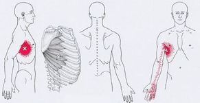 Карта триггеров: точки боли и точки напряжения мышц 