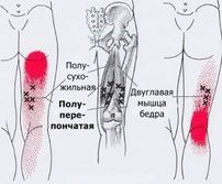 Карта триггеров: точки боли и точки напряжения мышц 